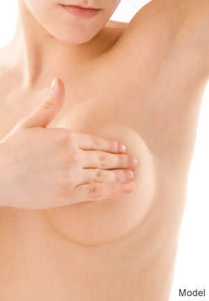 Breast Lift Model
